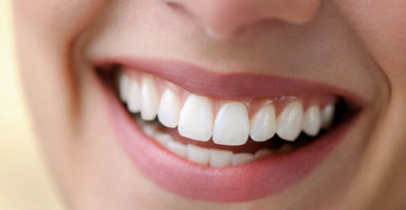 In aumento tra gli italiani l’utilizzo di sbiancanti per dent