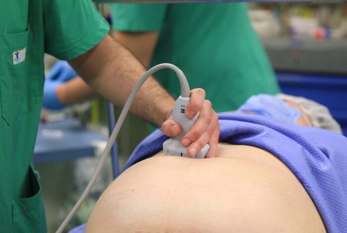roma bambin gesù intervento feto ancora pancia madre