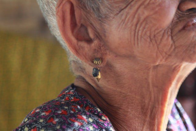 Come i rumori troppo forti causano la perdita dell’udito