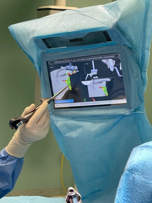Cassino, primo intervento di chirurgia plastica navigata presso l'ospedale Santa Scolastica